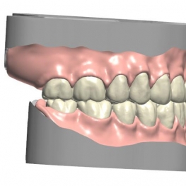 denture