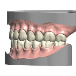 denture
