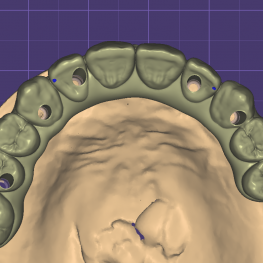 Screw Retained